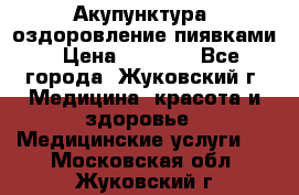 Акупунктура, оздоровление пиявками › Цена ­ 3 000 - Все города, Жуковский г. Медицина, красота и здоровье » Медицинские услуги   . Московская обл.,Жуковский г.